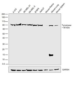 Invitrogen Tyrosinase Monoclonal Antibody (T311) 100 &mu;g; Unconjugated:Antibodies,