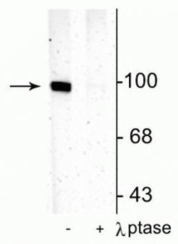 Invitrogen Phospho-GluR1 (Ser831) Polyclonal Antibody 150 &mu;L | Buy Online | Invitrogen&trade; | Fisher Scientific