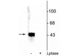 Invitrogen Phospho-ERK1/ERK2 (Thr202, Tyr204) Polyclonal Antibody 100 &mu;L;