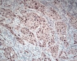 Invitrogen Phospho-ERK1/ERK2 (Thr202, Tyr204) Polyclonal Antibody 100 &mu;L;