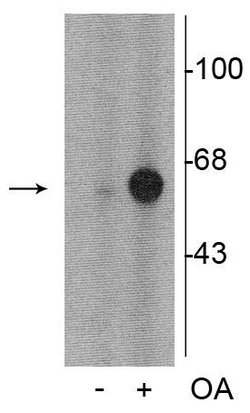 Invitrogen Phospho-Tyrosine Hydroxylase (Ser31) Polyclonal Antibody 100