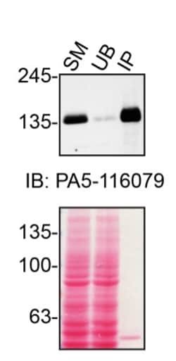 Invitrogen&trade;&nbsp;TSC1 Monoclonal Antibody (5C8A12)