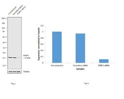 Invitrogen PEBP1 Monoclonal Antibody (3E12D7) 100 &mu;g; Unconjugated:Antibodies,