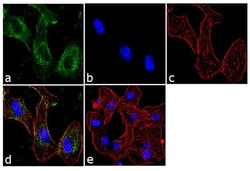 Invitrogen BTRC Monoclonal Antibody (1B1D2) 100 &mu;g; Unconjugated:Antibodies,
