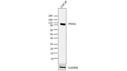 Invitrogen PSMA Monoclonal Antibody (1H8H5) 100 &mu;g; Unconjugated:Antibodies,