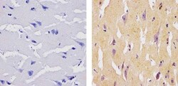 Invitrogen SOCS1 Monoclonal Antibody (4H1) 100 &mu;g; Unconjugated:Antibodies,