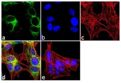 Invitrogen Ephrin B1 Monoclonal Antibody (2D3E9) 100 &mu;g; Unconjugated:Antibodies,