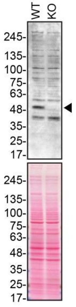 Invitrogen Parkin Monoclonal Antibody (PRK109) 100 &mu;g; Unconjugated:Antibodies,