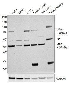 MTA1 Monoclonal Antibody (1F3F12), Invitrogen 1 mL; Unconjugated:Antibodies,