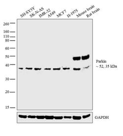 Invitrogen Parkin Monoclonal Antibody (PRK109) 100 &mu;g; Unconjugated:Antibodies,