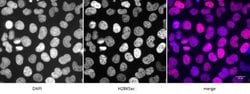 Histone H2BK5ac Polyclonal Antibody, Active Motif 200 &mu;L; Unconjugated:Antibodies,