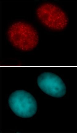 Histone H3K27ac Polyclonal Antibody, Active Motif 50 &mu;g; Unconjugated:Antibodies,