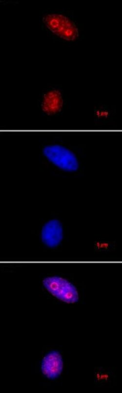 Histone H3K27me3 Polyclonal Antibody, Active Motif 10 &mu;g; Unconjugated:Antibodies,