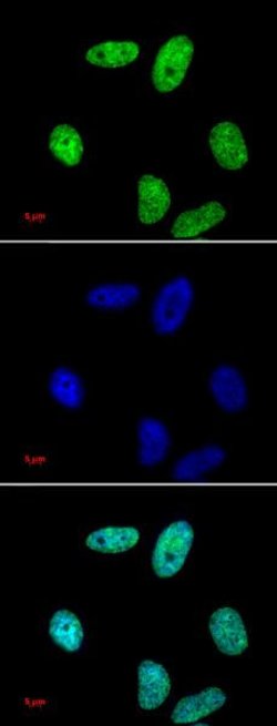 Histone H3K27me2 Polyclonal Antibody, Active Motif:Antibodies:Primary Antibodies