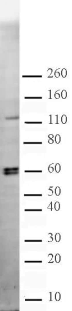 CARM1 Polyclonal Antibody, Active Motif 200 &mu;L; Unconjugated:Antibodies,