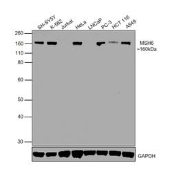 Invitrogen MSH6 Monoclonal Antibody (ZM006) 100 &mu;g; Unconjugated:Antibodies,