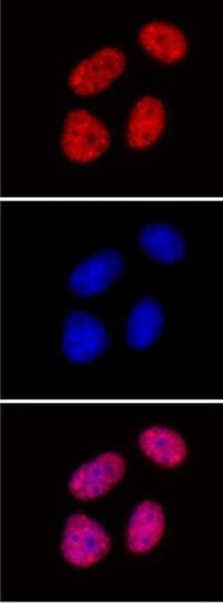Histone H3K27me2me3 Monoclonal Antibody (7B11), Active Motif 100 &mu;g;