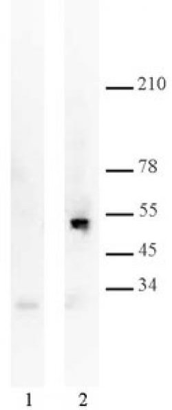 p53 Monoclonal Antibody (DO1), Active Motif 200 &mu;g; Unconjugated:Antibodies,