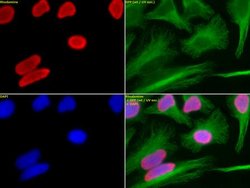 Histone H3K18ac Polyclonal Antibody, Active Motif 100 &mu;L; Unconjugated:Antibodies,