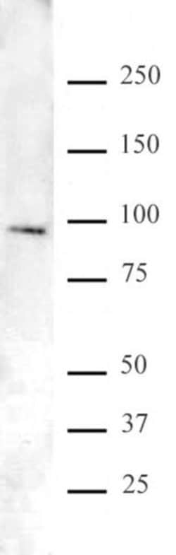 FOXO1/FKHR Polyclonal Antibody, Active Motif 200 &mu;L; Unconjugated:Antibodies,