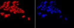 Histone H3K18ac Polyclonal Antibody, Active Motif:Antibodies:Primary Antibodies