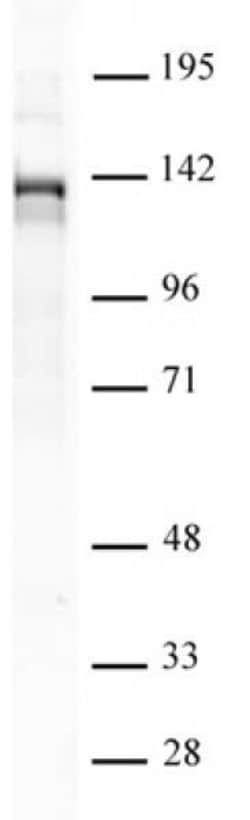 PHF8 Polyclonal Antibody, Active Motif 10 &mu;L | Buy Online | Active Motif | Fisher Scientific