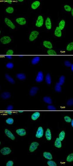 Histone H3K18ac Polyclonal Antibody, Active Motif 100 &mu;g; Unconjugated:Antibodies,