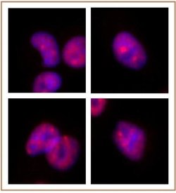 SMARCA2 / BRM Monoclonal Antibody (1H7A10), Active Motif:Antibodies:Primary