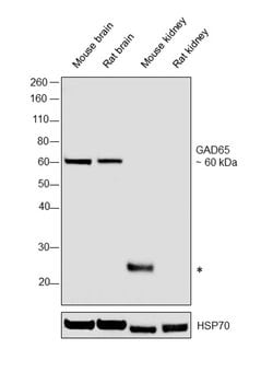 Invitrogen GAD65 Monoclonal Antibody (ZG002) 100 &mu;g; Unconjugated:Antibodies,