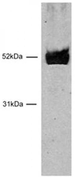 HNF-3 beta / FOXA2 Polyclonal Antibody, Active Motif 10 &mu;L | Buy Online | Active Motif | Fisher Scientific