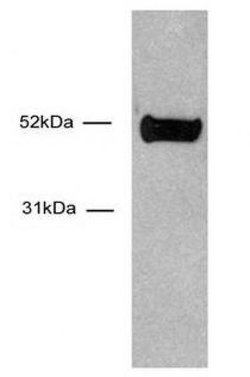 HNF-3 alpha / FOXA1 Monoclonal Antibody (2F83), Active Motif 100 &mu;g;
