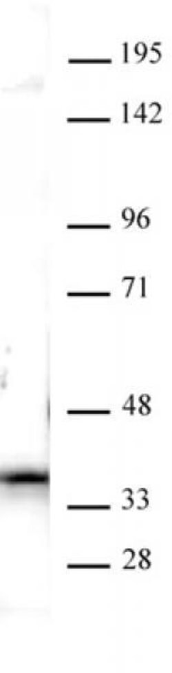 Nucleophosmin Polyclonal Antibody, Active Motif 100 &mu;L; Unconjugated:Antibodies,