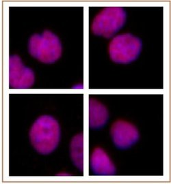 MMSET / WHSC1 Monoclonal Antibody (29D1), Active Motif 10 &mu;g; Unconjugated:Antibodies,