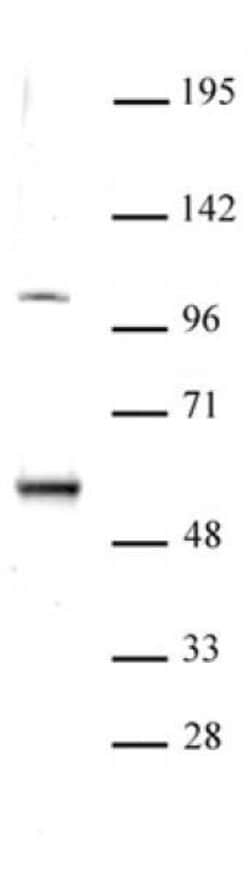 ELP3 Polyclonal Antibody, Active Motif:Antibodies:Primary Antibodies