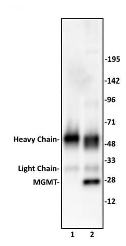 MGMT Polyclonal Antibody, Active Motif 10 &mu;L; Unconjugated:Antibodies,