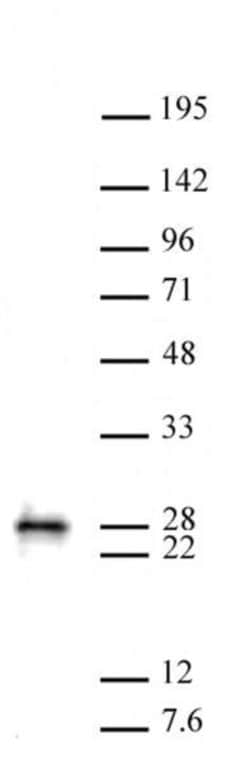 MGMT Polyclonal Antibody, Active Motif 10 &mu;L; Unconjugated:Antibodies,