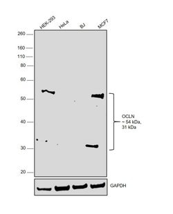 Invitrogen Occludin Polyclonal Antibody 100 &mu;g | Buy Online | Invitrogen&trade; | Fisher Scientific