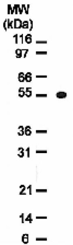 Osteoprotegerin (OPG) Mouse anti-Human, Clone: 98A1071, Active Motif 100