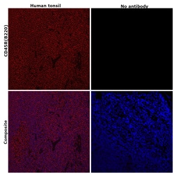 Invitrogen CD45R (B220) Monoclonal Antibody (RA3-6B2), eFluor 570, eBioscience