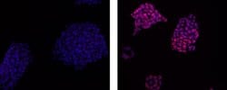 Rat IgG2a kappa Isotype Control (eBR2a), eFluor 570, eBioscience , Invitrogen:Antibodies:Isotype