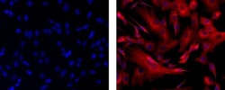 Invitrogen beta-3 Tubulin Monoclonal Antibody (2G10-TB3), eFluor 570, eBioscience