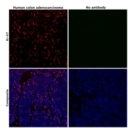 Ki-67 Monoclonal Antibody (SolA15), eFluor 570, eBioscience , Invitrogen:Antibodies:Primary