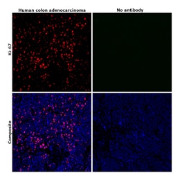 Ki-67 Monoclonal Antibody (SolA15), eFluor 570, eBioscience , Invitrogen:Antibodies:Primary