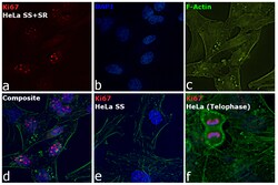 Ki-67 Monoclonal Antibody (SolA15), eFluor 570, eBioscience , Invitrogen:Antibodies:Primary