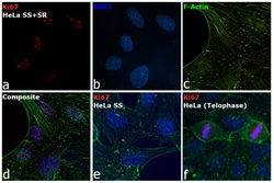 Invitrogen Ki-67 Monoclonal Antibody (20Raj1), eFluor 570, eBioscience