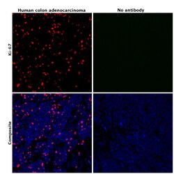 Invitrogen Ki-67 Monoclonal Antibody (20Raj1), eFluor 570, eBioscience