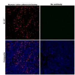 Invitrogen Ki-67 Monoclonal Antibody (20Raj1), eFluor 570, eBioscience