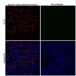 Invitrogen Ki-67 Monoclonal Antibody (20Raj1), eFluor 570, eBioscience