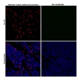 Invitrogen Ki-67 Monoclonal Antibody (20Raj1), eFluor 570, eBioscience