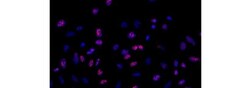 Invitrogen Ki-67 Monoclonal Antibody (20Raj1), eFluor 570, eBioscience